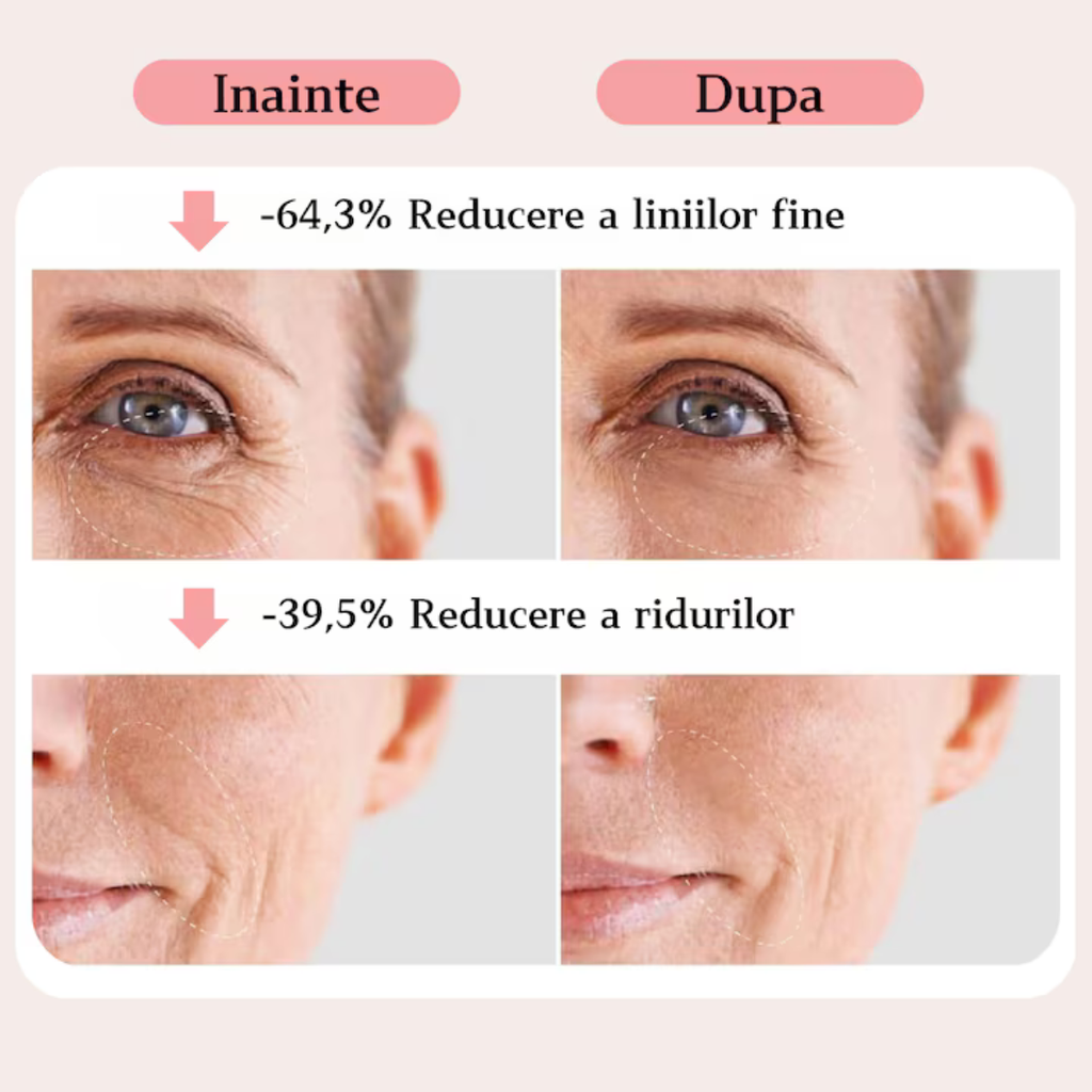 Dispozitiv masaj facial 6in1